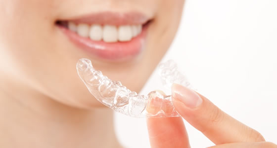 マウスピース矯正