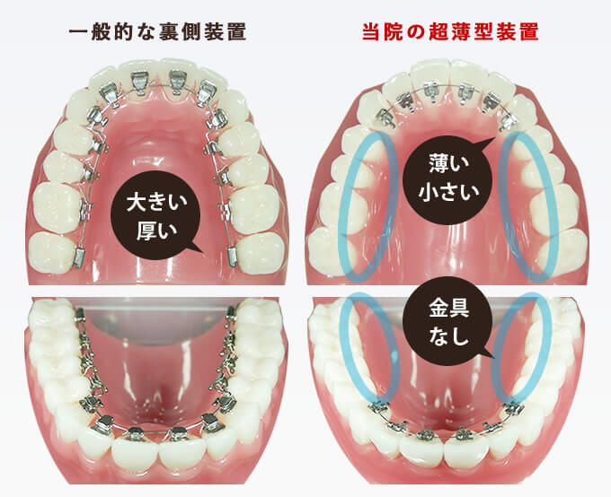 当院では超薄型の装置を最小限の設置のみ